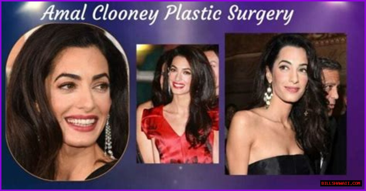 Amal Clooney Cosmetic Surgery: A Comprehensive Overview