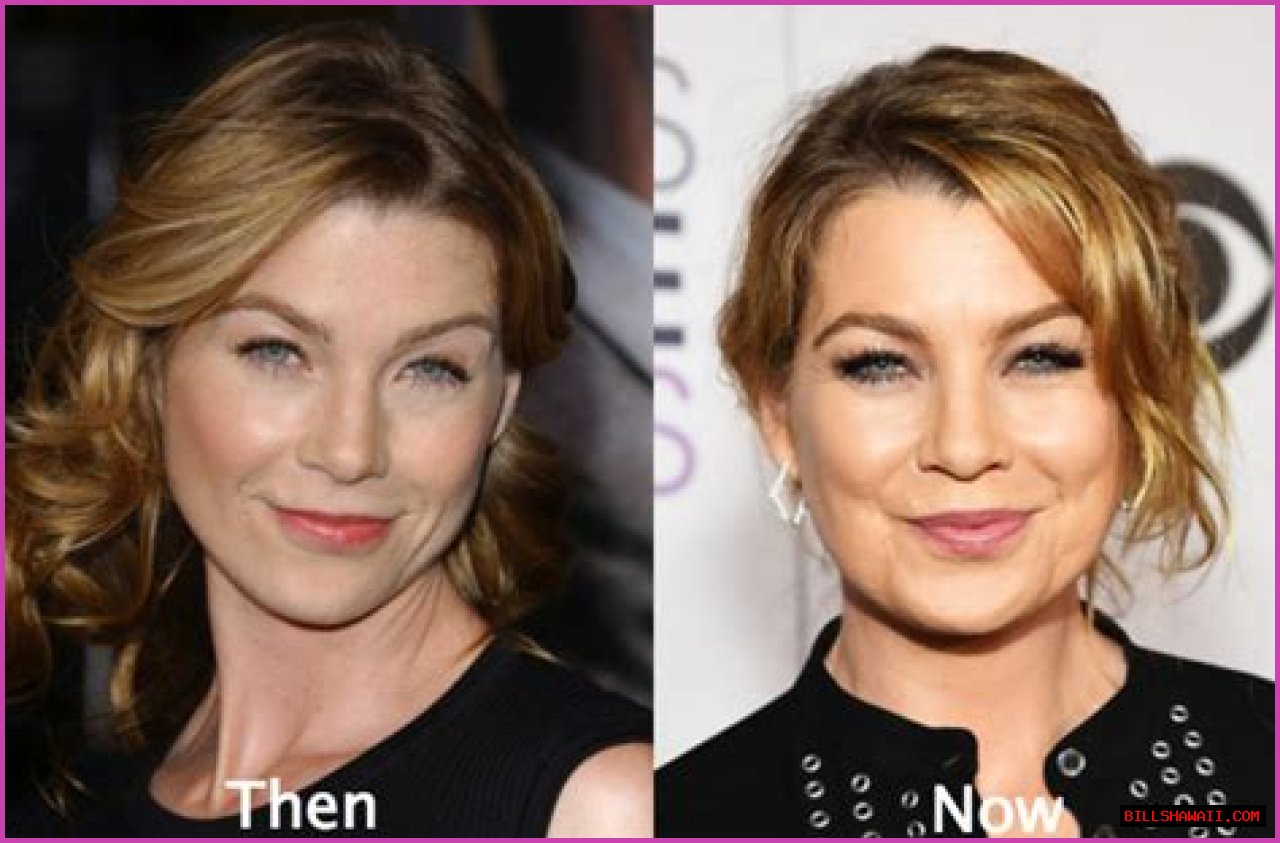 Ellen Pompeo Lip Filler: The Truth Behind Her Transformed Look
